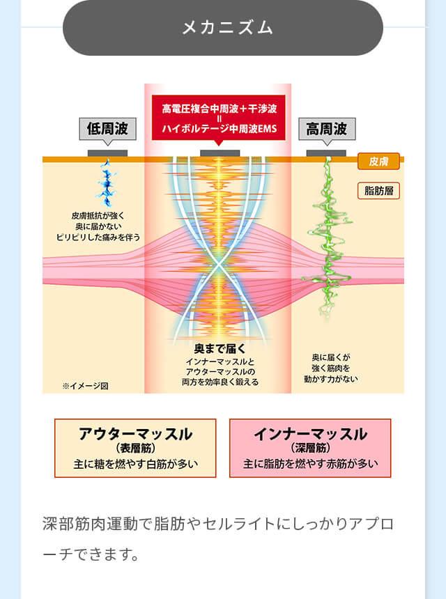 ハイボルテージ中周波のメカニズム